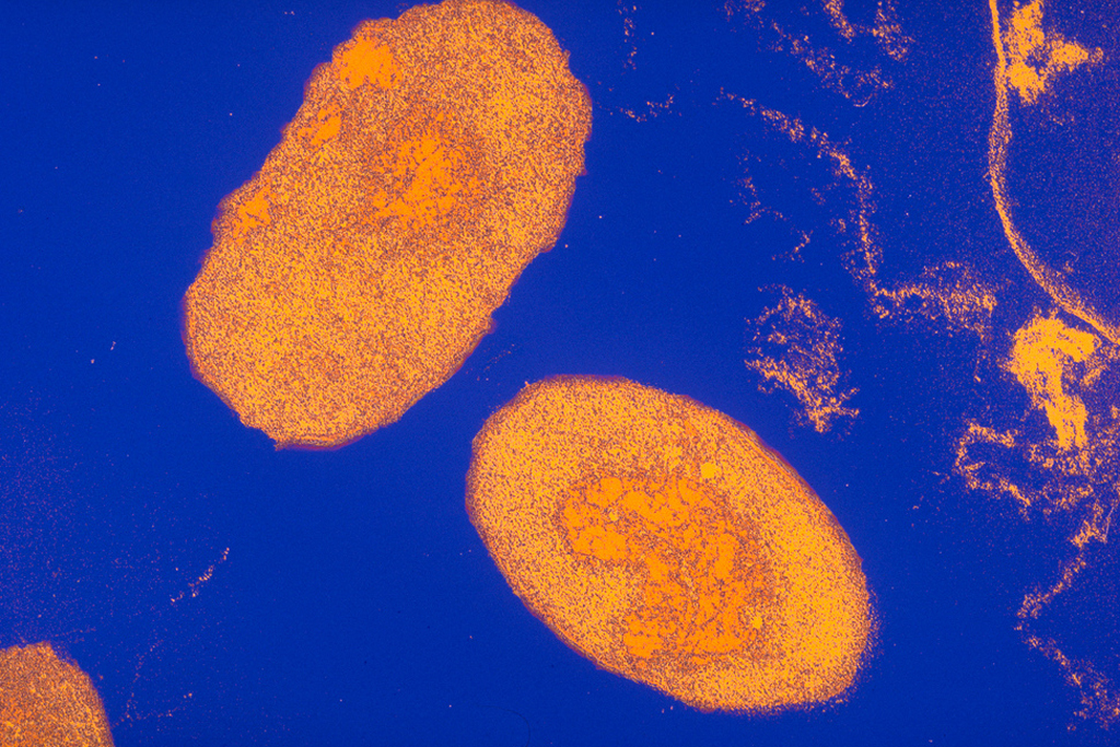 Orange spots float on a blue surface.